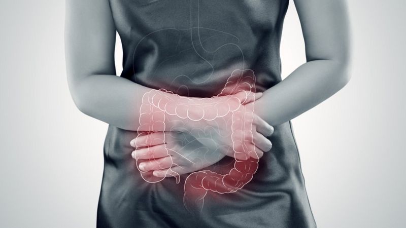 Cómo la terapia me ayudó con mi colon irritable